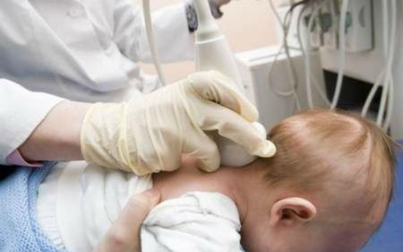 Чому новонароджена дитина може закидати голову назад